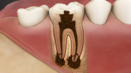 Endodontics