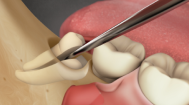 Oral and Maxillofacial