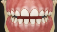 Pediatric Dentistry