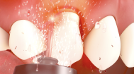 Periodontics