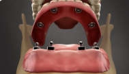 Prosthodontics