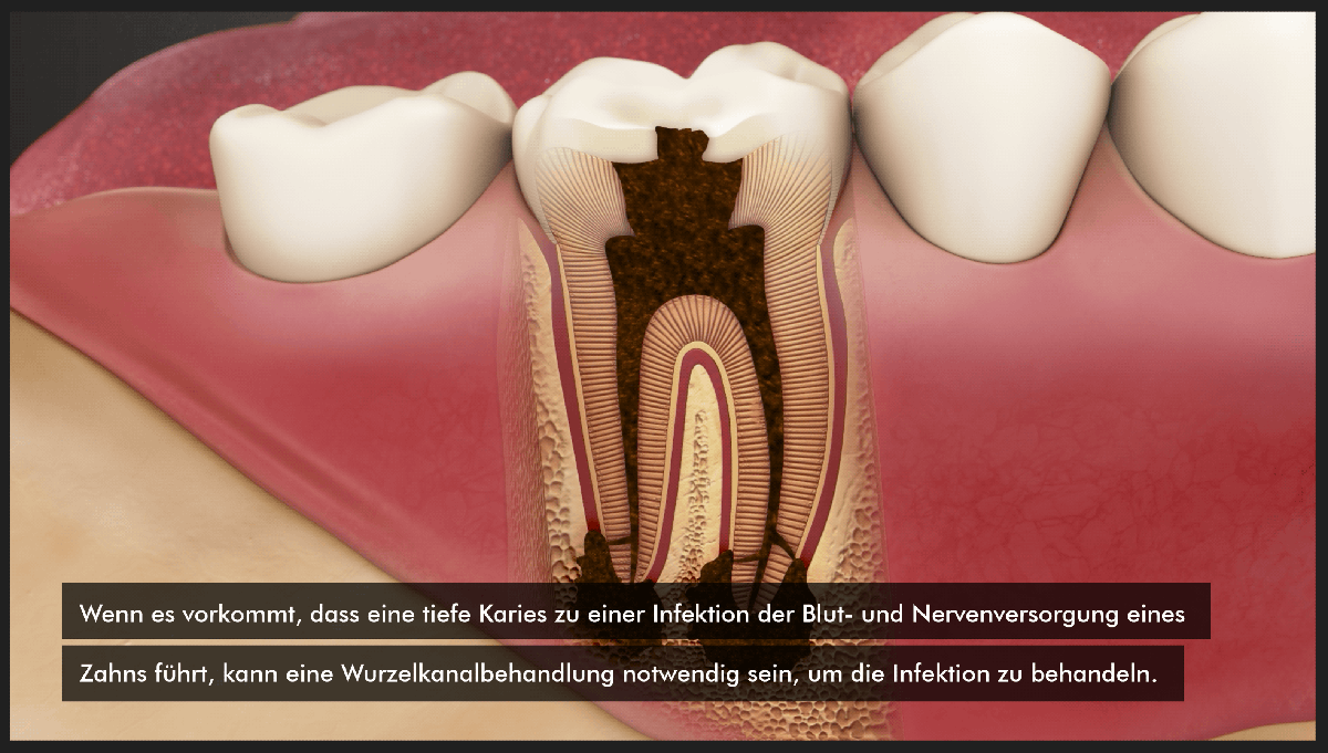 German